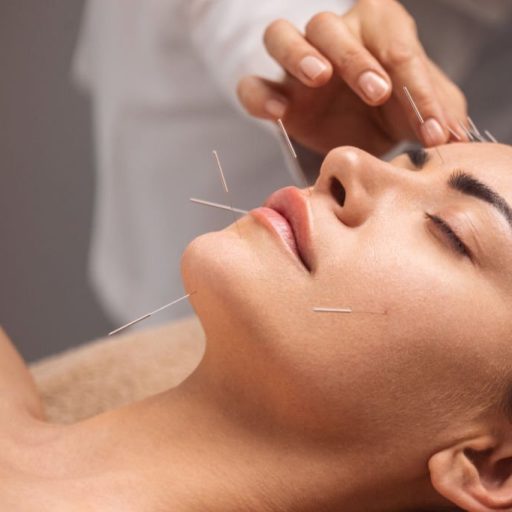 Acupuncture specialist inserting needle into patient's face due treatment. She is stimulating energy flow through the body for faster relaxation and recovery.